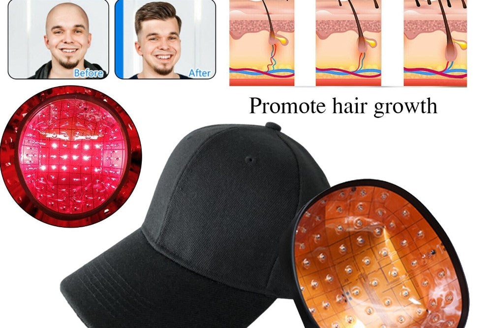 How Do I Choose the Right Laser Hair Cap? A Comprehensive Buying Guide
