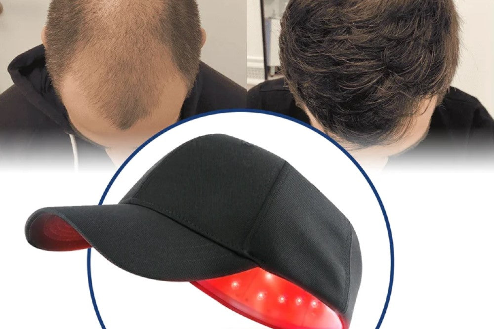 How Long Does It Take for Laser Hair Caps to Regrow Your Hair?