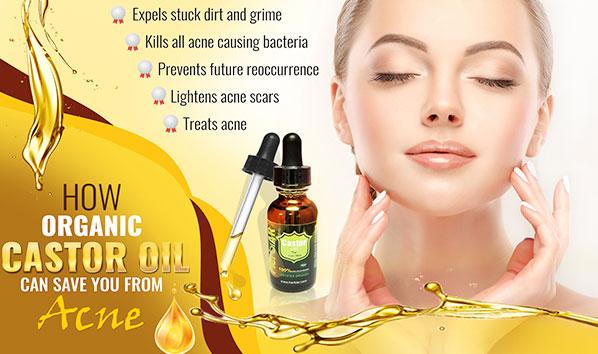 How Organic Castor Oil can Use as a Natural Acne Healer