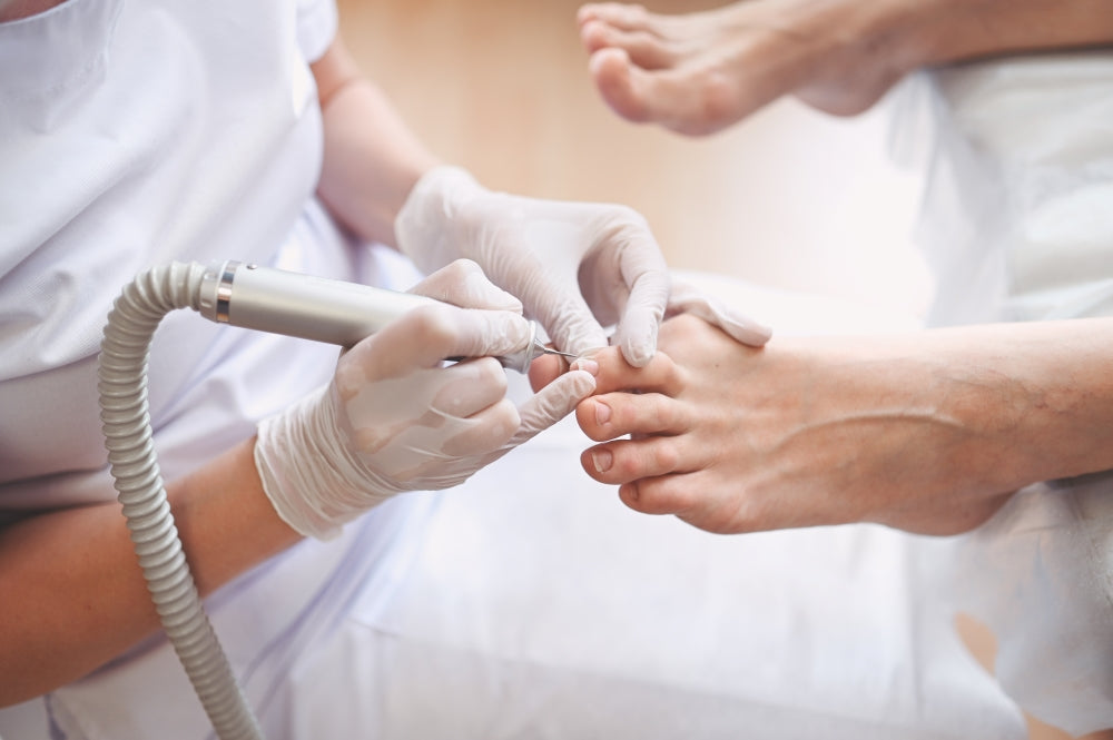 Why Nail Debridement Could Boost Your Toenail Fungus Treatment Results