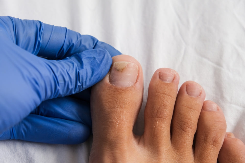 Onychomycosis: Current Trends in Toenail Fungus Diagnosis and Treatment