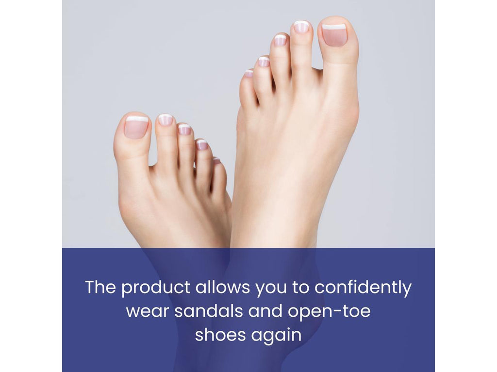 Natural Effective Nail Fungal Feet Repair Cream Foot Toe Nail Fungus Removal  Gel Anti Infection Paronychia Onychomyco Ointment - China Nail Fungus Pen,  Antifungal Nail Treatment | Made-in-China.com